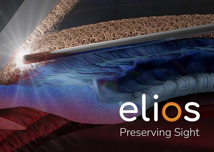 New Minimally Invasive Glaucoma Surgery Comes to Innovation Eye Clinic