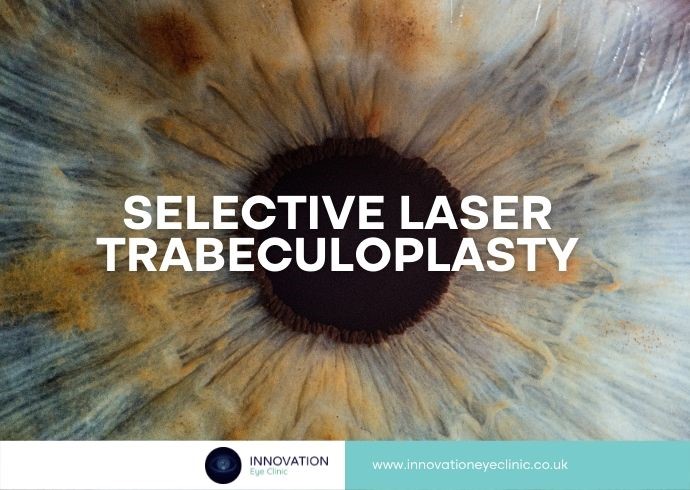 Selective Laser Trabeculoplasty