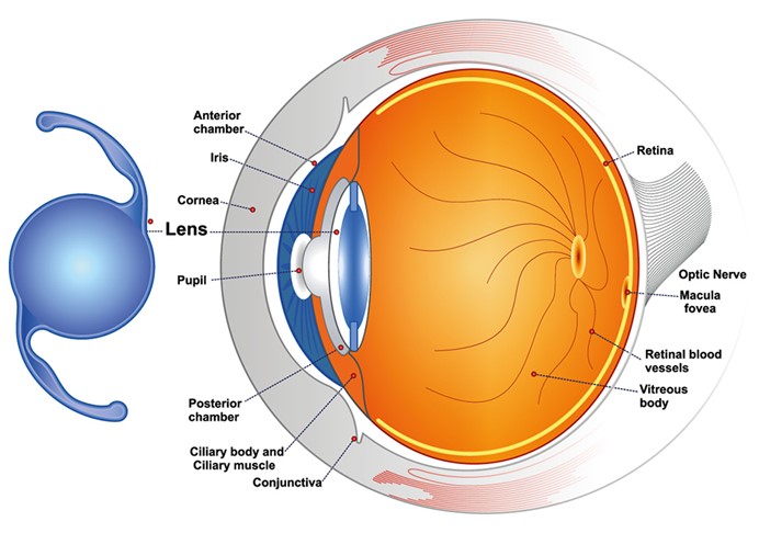 Innovation Eye Clinic Cataract Treatment Surgery Innovation Eye innovation-eye-clinic-cataract-treatment-surgery-innovation-eye