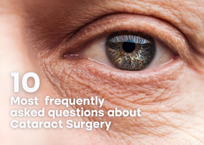 10 most frequently asked questions about cataract surgery